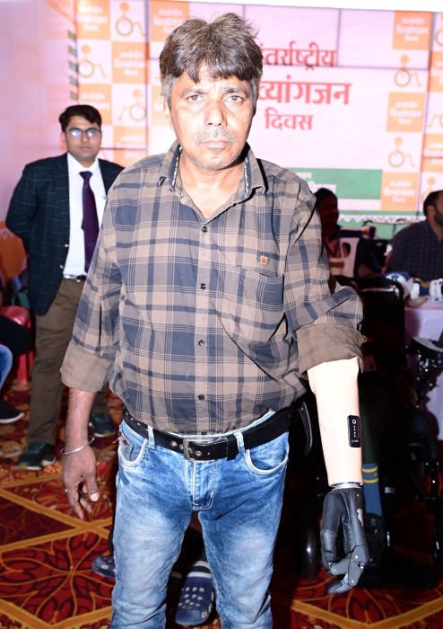 मोहन को जब मिला निःशुल्क कृत्रिम फंक्शनबेल हाथ, तो खिल उठा चेहरा, बोले अब सब कार्य स्वंय कर सकूंगा